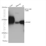 NCAM1/CD56 Antibody in Western Blot (WB)