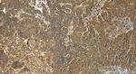 ATG13 Antibody in Immunohistochemistry (Paraffin) (IHC (P))