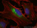 LDLR Antibody in Immunocytochemistry (ICC/IF)