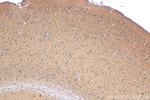 LDLR Antibody in Immunohistochemistry (Paraffin) (IHC (P))