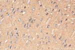 LDLR Antibody in Immunohistochemistry (Paraffin) (IHC (P))