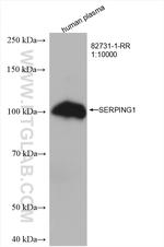 SERPING1 Antibody in Western Blot (WB)