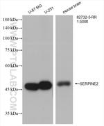 SERPINE2 Antibody in Western Blot (WB)