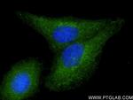 BST2 Antibody in Immunocytochemistry (ICC/IF)