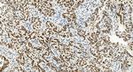 BOP1 Antibody in Immunohistochemistry (Paraffin) (IHC (P))