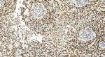 BOP1 Antibody in Immunohistochemistry (Paraffin) (IHC (P))