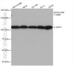 BOP1 Antibody in Western Blot (WB)