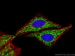 CHCHD3 Antibody in Immunocytochemistry (ICC/IF)