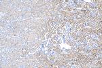 IGF2BP2 Antibody in Immunohistochemistry (Paraffin) (IHC (P))