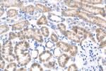 IGF2BP2 Antibody in Immunohistochemistry (Paraffin) (IHC (P))
