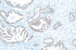 IGF2BP2 Antibody in Immunohistochemistry (Paraffin) (IHC (P))