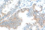 IGF2BP2 Antibody in Immunohistochemistry (Paraffin) (IHC (P))
