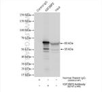 IGF2BP2 Antibody in Immunoprecipitation (IP)