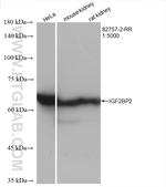 IGF2BP2 Antibody in Western Blot (WB)