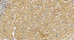 OGDH Antibody in Immunohistochemistry (Paraffin) (IHC (P))