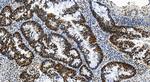 MSH2 Antibody in Immunohistochemistry (Paraffin) (IHC (P))