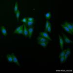 Albumin Antibody in Immunocytochemistry (ICC/IF)