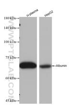 Albumin Antibody in Western Blot (WB)