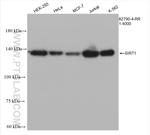 SIRT1 Antibody in Western Blot (WB)