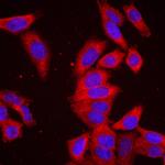 UPF1 Antibody in Immunocytochemistry (ICC/IF)