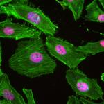 HNRNPC Antibody in Immunocytochemistry (ICC/IF)