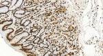 HNRNPC Antibody in Immunohistochemistry (Paraffin) (IHC (P))