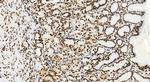 HNRNPC Antibody in Immunohistochemistry (Paraffin) (IHC (P))