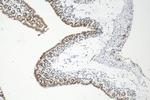HNRNPC Antibody in Immunohistochemistry (Paraffin) (IHC (P))