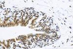 HNRNPC Antibody in Immunohistochemistry (Paraffin) (IHC (P))