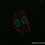 Lamin B2 Antibody in Immunocytochemistry (ICC/IF)