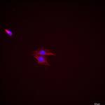 Calretinin Antibody in Immunocytochemistry (ICC/IF)