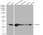 Calretinin Antibody in Western Blot (WB)