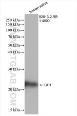 GH1 Antibody in Western Blot (WB)