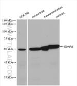 EDNRB Antibody in Western Blot (WB)