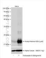 Acetyl-Histone H2A (Lys9) Antibody in Western Blot (WB)