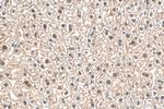 CLOCK Antibody in Immunohistochemistry (Paraffin) (IHC (P))