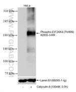 Phospho-EIF2AK4 (Thr899) Antibody in Western Blot (WB)