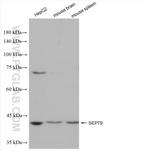 SEPT9 Antibody in Western Blot (WB)