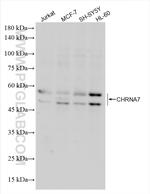 CHRNA7 Antibody in Western Blot (WB)