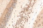 FBXO44 Antibody in Immunohistochemistry (Paraffin) (IHC (P))