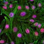 TAF15 Antibody in Immunocytochemistry (ICC/IF)