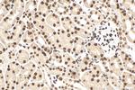 TAF15 Antibody in Immunohistochemistry (Paraffin) (IHC (P))