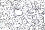 TAF15 Antibody in Immunohistochemistry (Paraffin) (IHC (P))