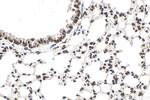 TAF15 Antibody in Immunohistochemistry (Paraffin) (IHC (P))