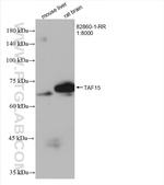 TAF15 Antibody in Western Blot (WB)