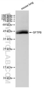 SFTPB Antibody in Western Blot (WB)
