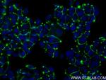 ZO-1 Antibody in Immunocytochemistry (ICC/IF)