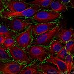 ZO-1 Antibody in Immunocytochemistry (ICC/IF)