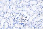 ZO-1 Antibody in Immunohistochemistry (Paraffin) (IHC (P))