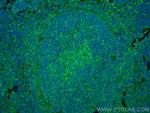 NOX2 Antibody in Immunohistochemistry (PFA fixed) (IHC (PFA))
